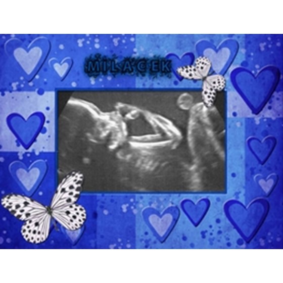 Štěpánek Sedláček